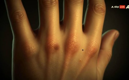 क्या आपका हाथ भी पड़ रहा है पीला? जान लीजिए ये बीमारी कितनी खतरनाक