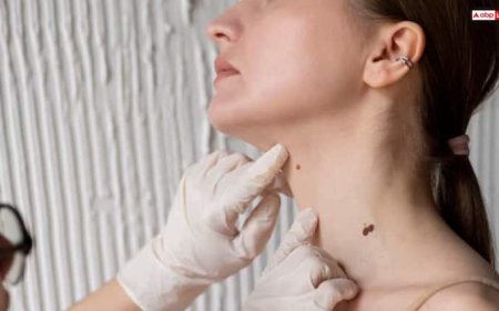 शरीर में इस जगह हो गया है मस्सा तो तुरंत हो जाएं सावधान, कैंसर का हो सकता है लक्षण