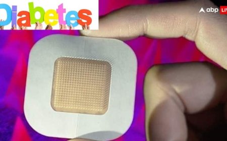 बिना सुई, बिना दर्द, हर 5 मिनट में ब्लड शुगर बताएगा ये खास पैच, जानें इसकी खासियत