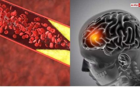कोलेस्ट्रॉल कंट्रोल करने के लिए रोजाना पिएं ये 6 तरह का जूस, स्ट्रोक का खतरा भी होगा कम