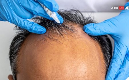 इन लोगों के लिए जानलेवा हो सकता है हेयर ट्रांसप्लांट, जरूर बरतें ये सावधानी