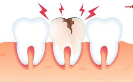 इन कारणों से दांतों में होने लगती है कैविटी की शिकायत, जानिए कैसे पाएं छुटकारा