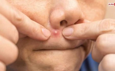 इस जगह की फुंसी फोड़ने से डैमेज हो सकता है आपका दिमाग, कहलाता है 'ट्रायंगल ऑफ डेथ'