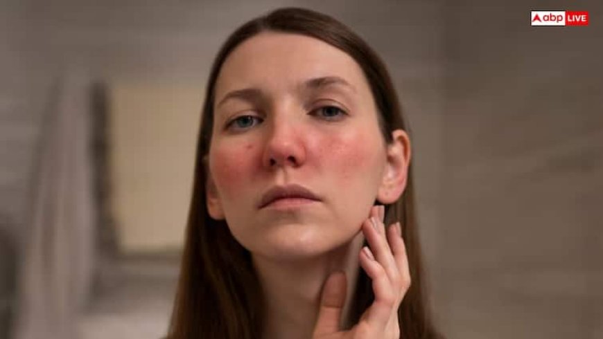 इन चीजों की वजह से होती है सबसे ज्यादा पिगमेंटेशन, ऐसे कर सकते हैं बचाव 