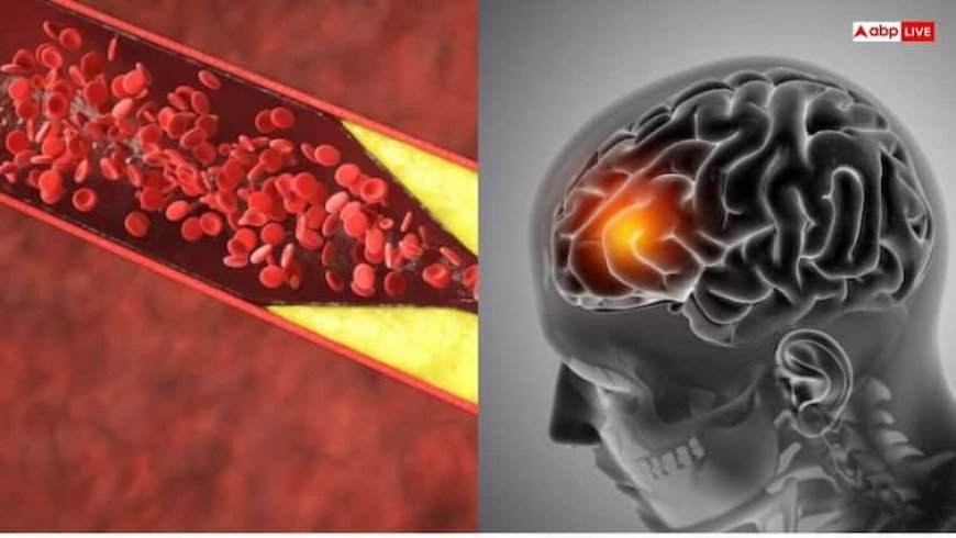 कोलेस्ट्रॉल कंट्रोल करने के लिए रोजाना पिएं ये 6 तरह का जूस, स्ट्रोक का खतरा भी होगा कम