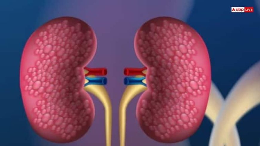 किडनी में भी लग सकता है फंगस, बार-बार बढ़ रहा है शुगर तो हो जाएं सावधान