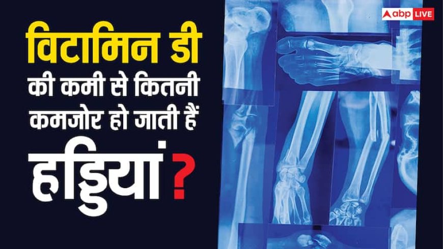 सनबर्न से बचने के लिए ताउम्र धूप में नहीं गई यह महिला, अब सोते-सोते टूट गई हड्डी, जानें क्यों हुआ ऐसा?