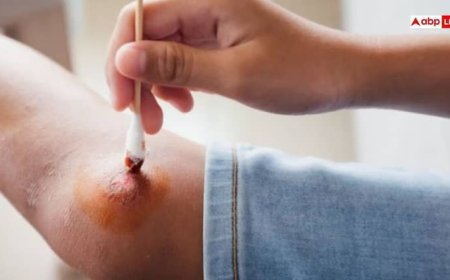 चोट लगने से आने लगे खून तो सबसे पहले करें ये काम, एक गलती भी हो सकती है खतरनाक