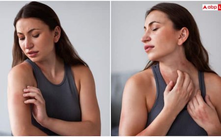 चिप-चिप वाली गर्मी में आपको भी होने लगी हैं घमौरियां? ये 10 देसी इलाज आएंगे काम