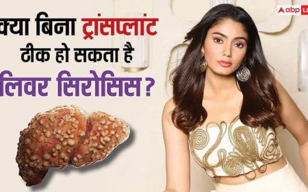 क्या बिना ट्रांसप्लांट ठीक हो सकता है सना मकबूल का लिवर सिरोसिस, ऐसा होना कितना पॉसिबल?