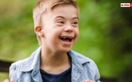 क्रोमोसोम में बदलाव की वजह से कैसे होता है डाउन सिंड्रोम, हजार में से एक बच्चे को है ये बीमारी