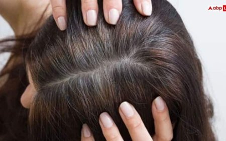 30 की उम्र में ही सफेद होने लगे हैं आपके बाल? तो आज से लगाना शुरू कर दें ये असरदार तेल