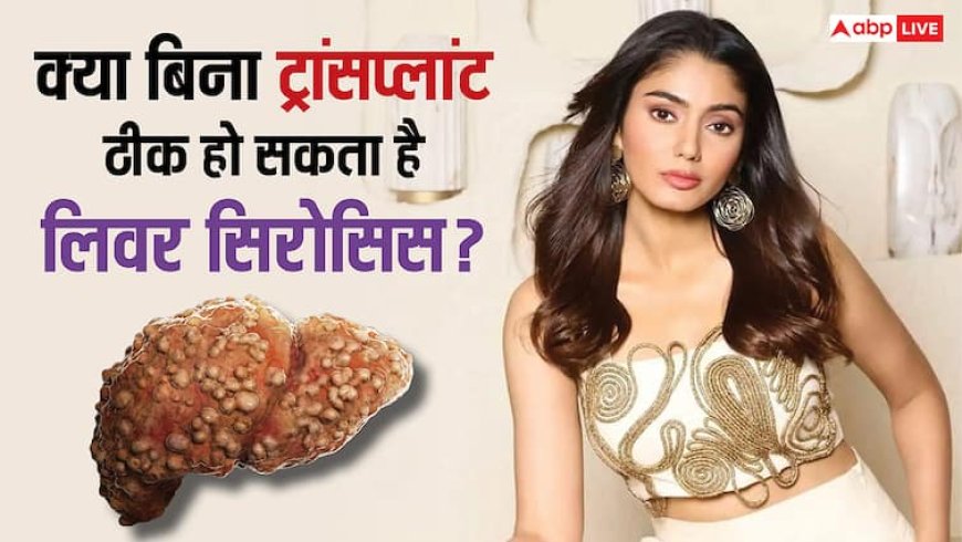 क्या बिना ट्रांसप्लांट ठीक हो सकता है सना मकबूल का लिवर सिरोसिस, ऐसा होना कितना पॉसिबल?