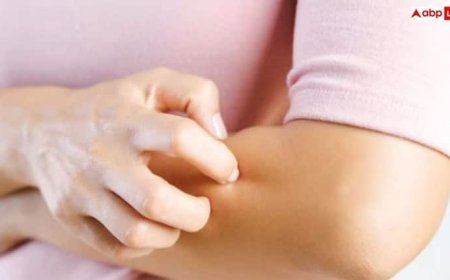 खुजली वाली त्वचा का देसी इलाज, राहत दिलाएंगे ये 6 घरेलू नुस्खे