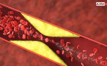 कोलेस्ट्रॉल बढ़ने पर आंखों में दिखते हैं ये बदलाव, जानें लक्षण