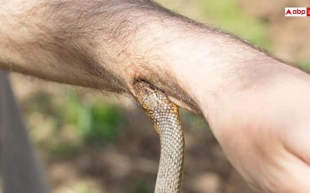 किसी को सांप काट ले तो उसे सबसे पहले क्या देना चाहिए? ये रहा जवाब