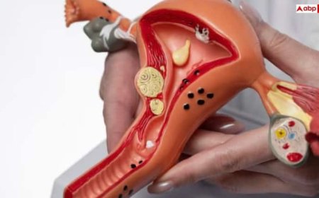 क्या पीसीओएस होने पर प्रेगनेंसी में आती है परेशानी, इसे ठीक कैसे किया जा सकता है