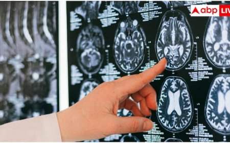 स्ट्रोक और डिमेंशिया से ब्रेन रहेगा एकदम सेफ, एम्स के डॉक्टर ने बताए 5 रामबाण तरीके