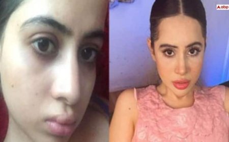 क्या है लिप फिलर, जिसे हटवाने के बाद सूज गया उर्फी जावेद का चेहरा?