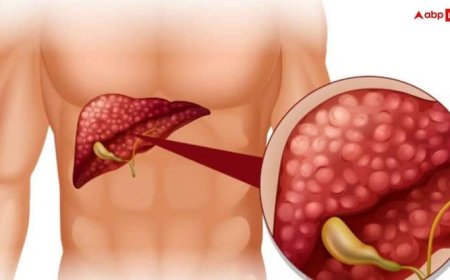 फैटी लिवर का इलाज आपके घर में छुपा है, इन तरीकों से करें  देखभाल