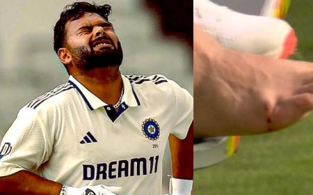 Rishabh Pant Scan Report: ऋषभ पंत पूरी टेस्ट सीरीज से बाहर, मेडिकल रिपोर्ट में फ्रैक्चर की पुष्टि; ठीक होने में लगेगा इतना समय