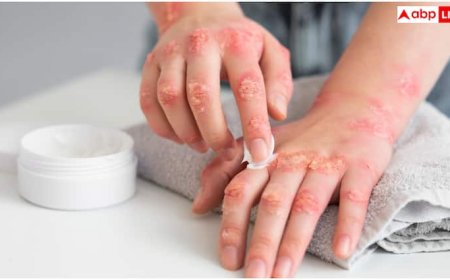 थीम पार्क से लौटते ही दबोच लेती है यह खतरनाक बीमारी, हाथ-पैरों समेत पूरे शरीर की हो जाती है ऐसी हालत