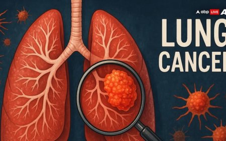 Lung Cancer Day: कैसे होती है लंग कैंसर की जांच, किस स्टेज तक बच सकती है मरीज की जान?