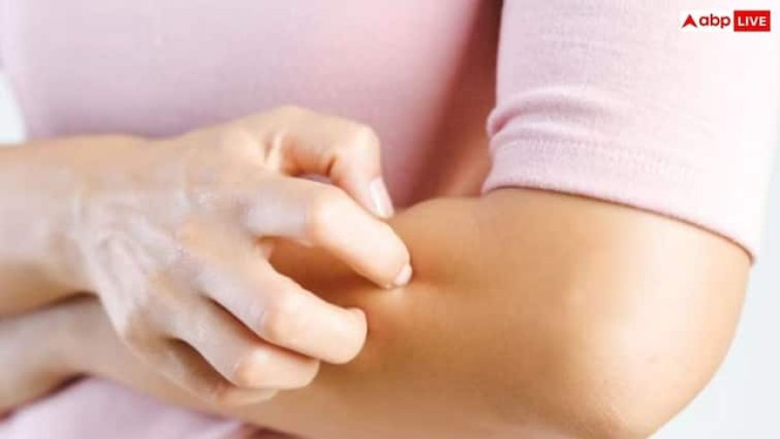 खुजली वाली त्वचा का देसी इलाज, राहत दिलाएंगे ये 6 घरेलू नुस्खे