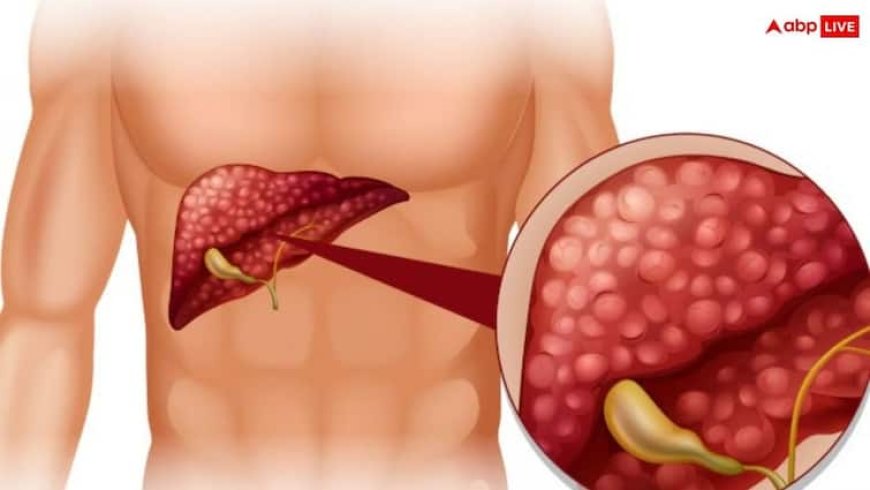 फैटी लिवर का इलाज आपके घर में छुपा है, इन तरीकों से करें  देखभाल
