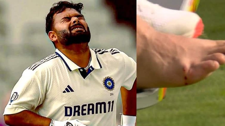 Rishabh Pant Scan Report: ऋषभ पंत पूरी टेस्ट सीरीज से बाहर, मेडिकल रिपोर्ट में फ्रैक्चर की पुष्टि; ठीक होने में लगेगा इतना समय