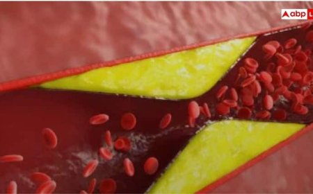 कोलेस्ट्रॉल बढ़ने पर इन हिस्सों में होता है दर्द, संकेत दिखाई देते ही भागें डॉक्टर के पास