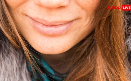 होंठ फट रहे हैं या कोनों से कट रहे हैं तो समझ जाएं इस विटामिन की हो गई कमी, ऐसे दूर करें यह दिक्कत