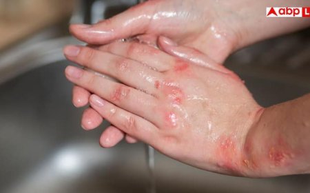 क्या कुछ भी पकड़ने पर कांपने लगते हैं आपके भी हाथ? इन 3 विटामिन्स की कमी से होता है ऐसा