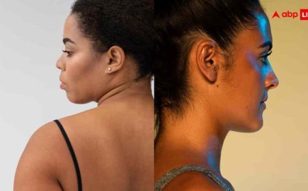 गर्दन के आसपास बनने लगा काले रंग का घेरा, इस बीमारी के शिकार तो नहीं हो रहे आप?