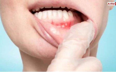 मुंह में दिख रहे हैं ये 6 लक्षण तो जान लें शरीर में कई चीजों की कमी, तुरंत डॉक्टर से लें सलाह