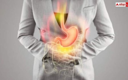 Health Tips: एसडिटी ठीक करने का आसान तरीका, आज से ही डाइट में शामिल करें ये चीजें