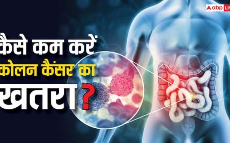 Colon Cancer: ये 7 फूड तुरंत खाना छोड़ दें तो कम हो जाएगा कोलन कैंसर होने का खतरा, यूथ में ज्यादा बढ़ रहा खतरा