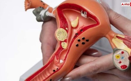 Symptoms of PCOS: पीसीओएस होने पर दिखते हैं ये लक्षण, कहीं आपको तो नहीं होती ये दिक्कत