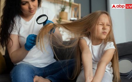 Home Remedies For Head Lice: सिर की खाल को नोच-नोचकर खा रहीं जुएं तो न हो परेशान, इन टिप्स से पलभर में होगा सफाया