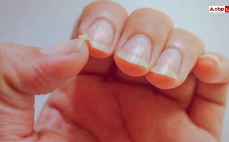 Nail Marks Symptoms: नाखून के ऊपर दिख रहा है ये निशान तो समझ लीजिए इस चीज की हो गई कमी, कई इशारे करते हैं हमारे नाखून