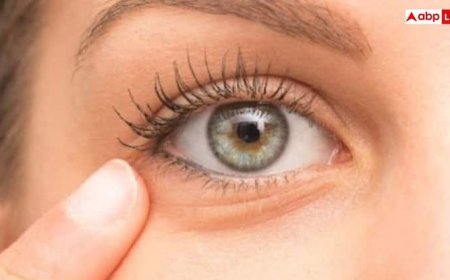 Alum for Dark Circle: डार्क सर्कल्स कम करने के लिए एलम का इस्तेमाल, क्या यह प्राकृतिक उपाय सच में काम करता है?