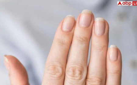 White Marks On Nails: आपके नाखूनों पर बन गया है व्हाइट निशान, जानें किस बीमारी का है संकेत