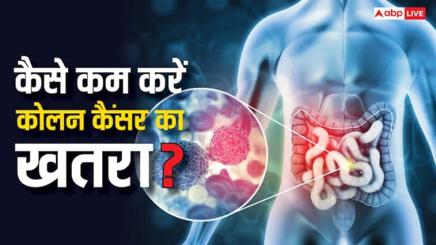 Colon Cancer: ये 7 फूड तुरंत खाना छोड़ दें तो कम हो जाएगा कोलन कैंसर होने का खतरा, यूथ में ज्यादा बढ़ रहा खतरा