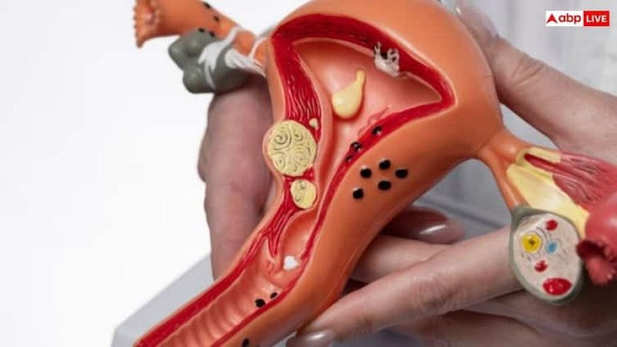 Symptoms of PCOS: पीसीओएस होने पर दिखते हैं ये लक्षण, कहीं आपको तो नहीं होती ये दिक्कत