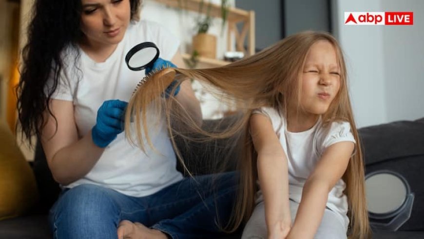 Home Remedies For Head Lice: सिर की खाल को नोच-नोचकर खा रहीं जुएं तो न हो परेशान, इन टिप्स से पलभर में होगा सफाया