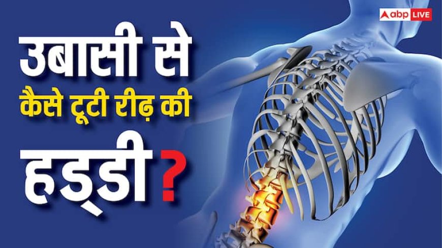 Yawning Ealth Problem: सुबह उठते ही उबासी ली और टूट गई रीढ़ की हड्डी, डॉक्टर से जानें क्यों हुआ ऐसा?