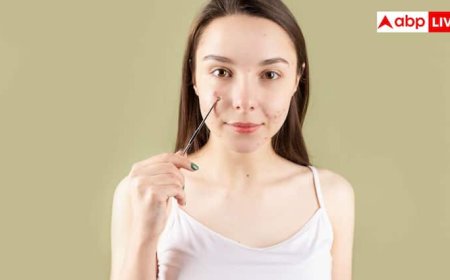 चेहरे पर पिंपल्स के निशान नहीं जा रहे, इसे ऐसे कर सकते हैं जड़ से खत्म?