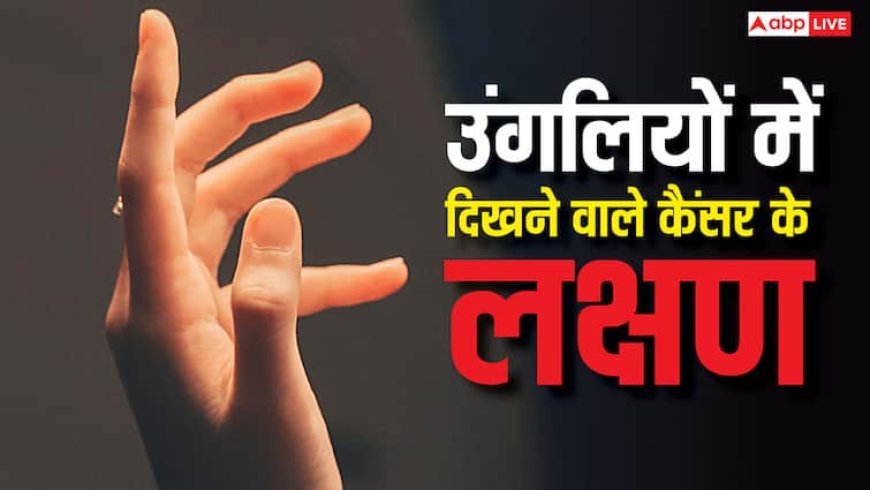 Early Signs of Lung Cancer: उंगलियों और नाखूनों में दिखते हैं लंग कैंसर के ये लक्षण, इन्हें गलती से भी न करना इग्नोर वरना हो जाएगी मौत
