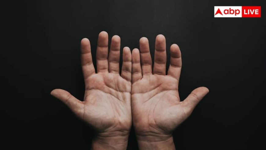 क्या ठंड शुरू होते ही सूज जाती हैं हाथ-पैर की उंगलियां, जानिए क्या है दिक्कत