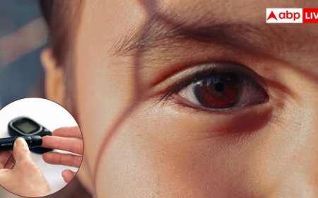 यंग डायबिटीज पेशेंट्स में सबसे पहले आंखों पर दिखता है असर, जानें क्या है डायबिटिक रेटिनोपैथी?